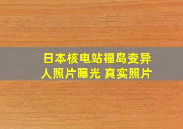 日本核电站福岛变异人照片曝光 真实照片